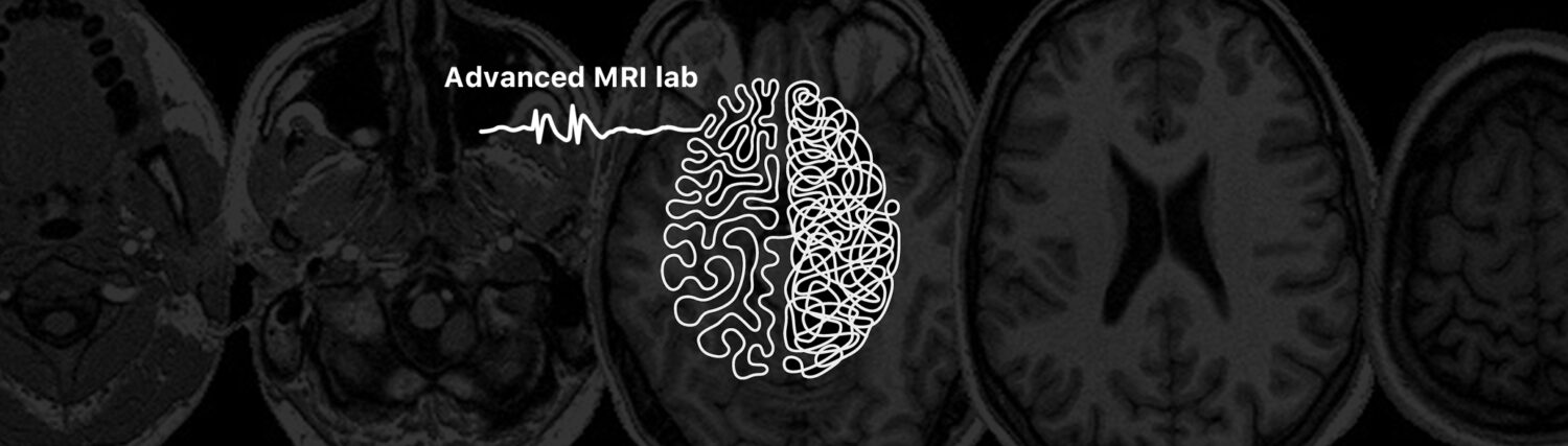 Laboratorio MRI epilepsy