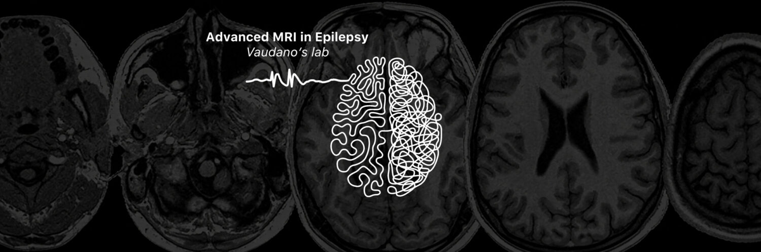 Laboratorio MRI epilepsy